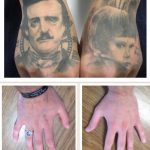 two human faces tattoos tattoo removal back of hands