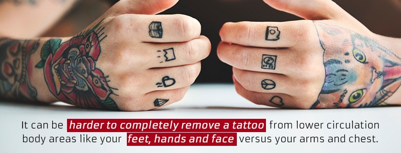 Areas where there there is less blood circulation will take longer to remove a tattoo