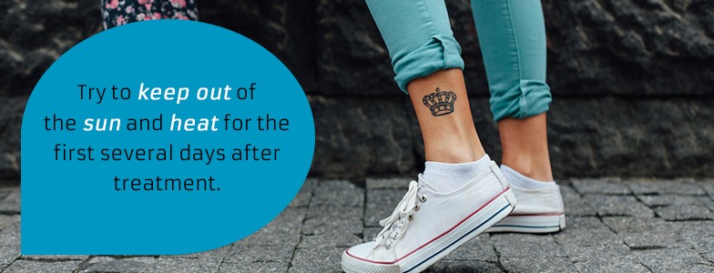 Avoid the sun and heat for the first few days after your laser tattoo removal treatment session