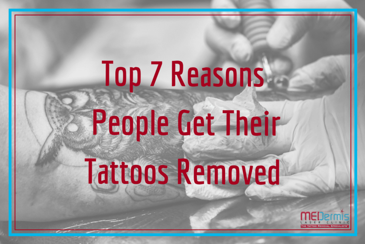 Why do people get tattoos removed