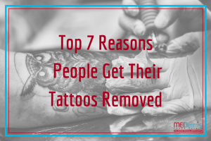 Top 7 Reasons People Remove Their Tattoos | MEDermis Laser Clinic