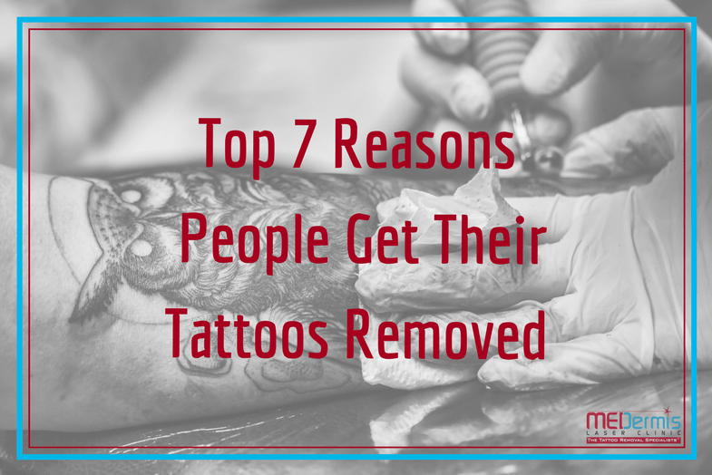 Top 7 Reasons People Get Tattoos Removed