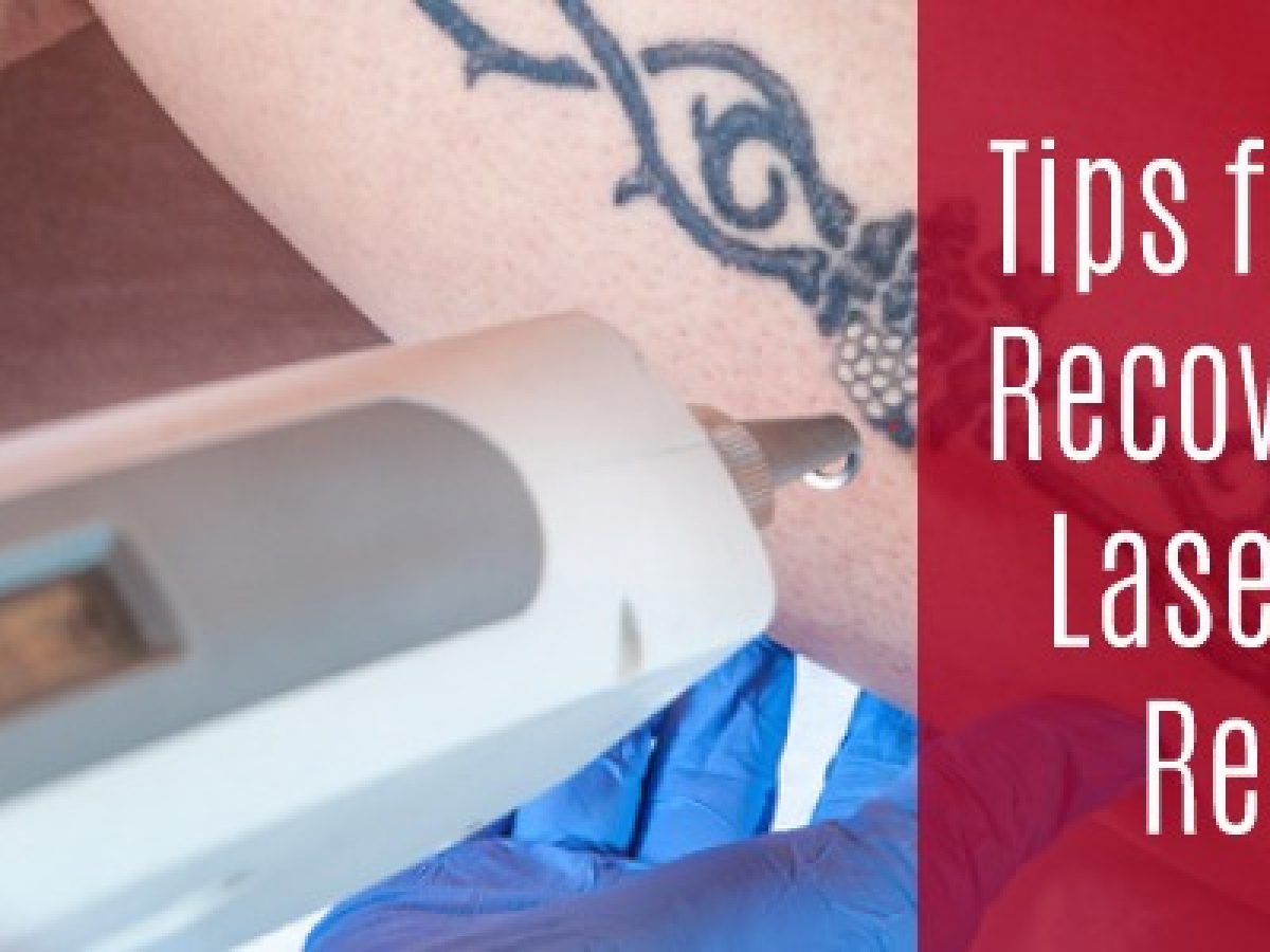 Tips for Faster, Pain and Scar-Free Laser Tattoo Removal Healing