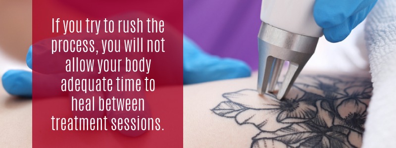 Allow ample time between laser tattoo removal sessions for proper healing