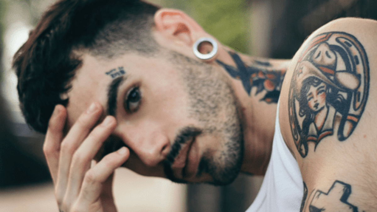 10 Questions to Ask A Laser Tattoo Removal Clinic