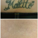 mailito fancy font tattoo removal lower back