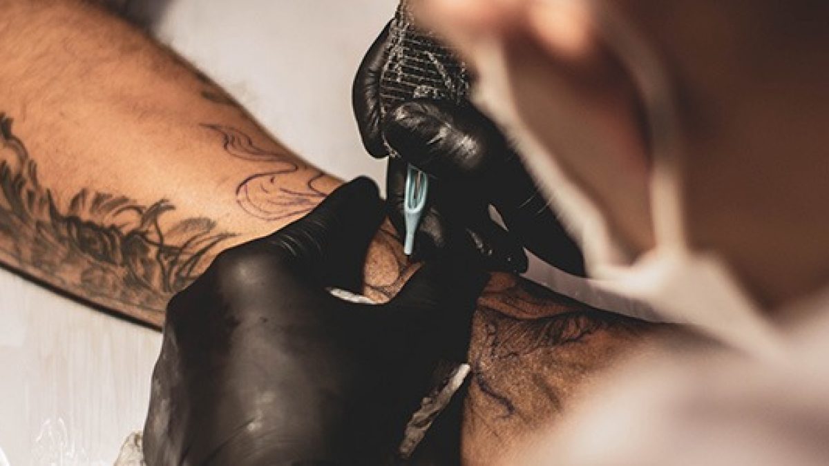 What Is the Best Tattoo Removal Technology Available?