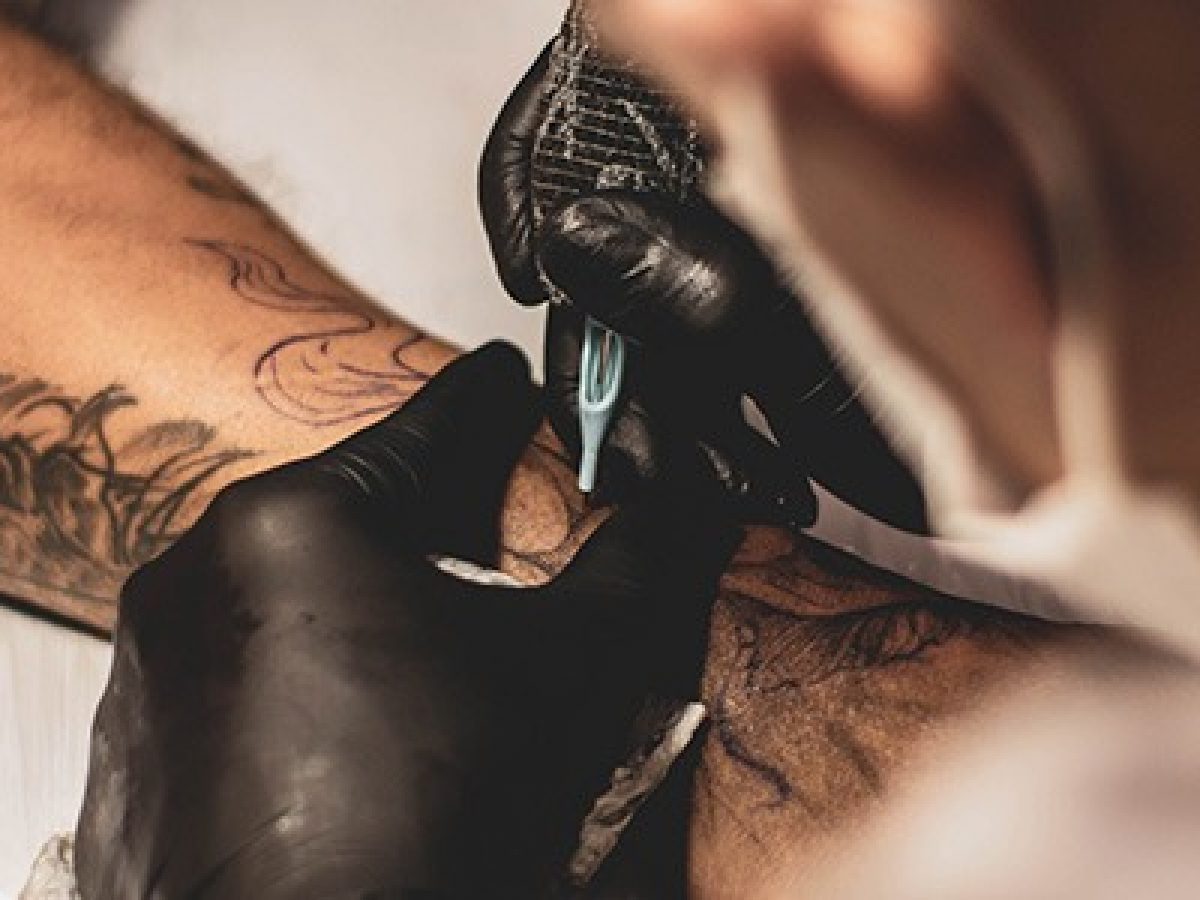 What Is the Best Tattoo Removal Technology Available?