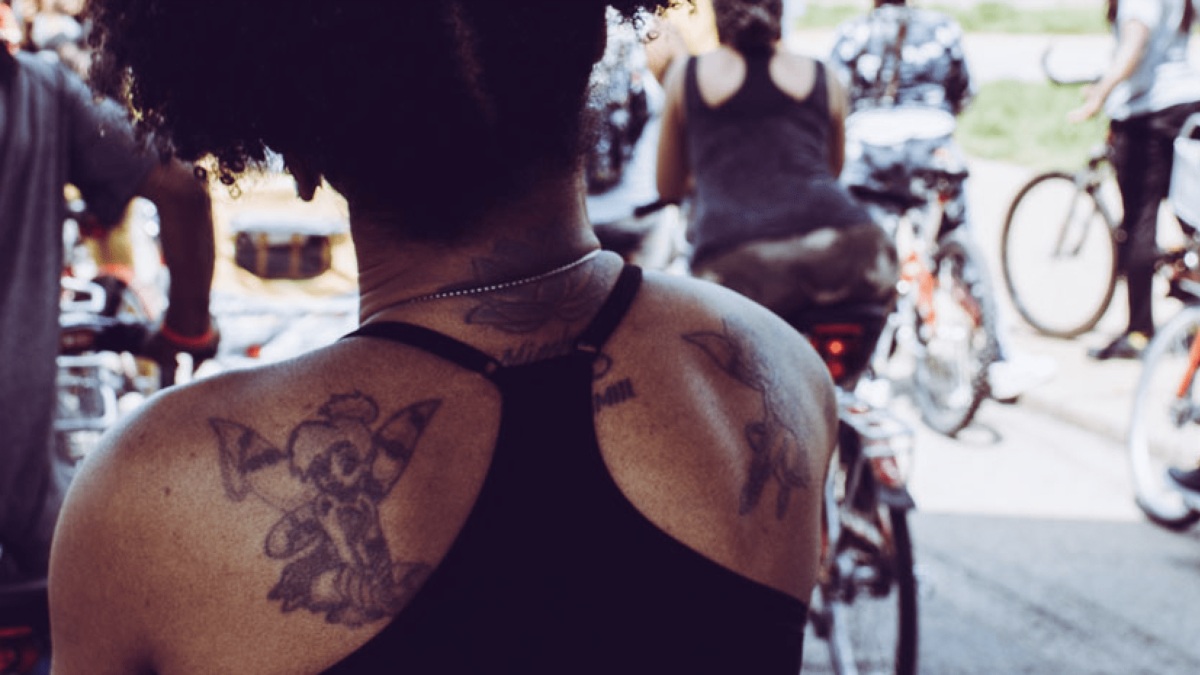 Large Tattoo Removal: What You Need To Know