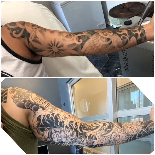 inside arm coverup